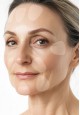 AntiWrinkle Patches